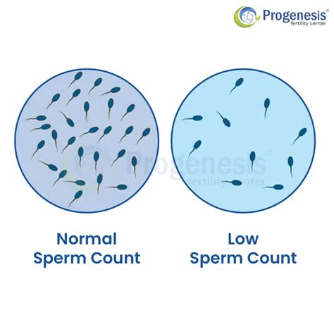 Low sperm count